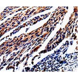 Immunohistochemistry - KLK3 Antibody from Signalway Antibody (35547) - Antibodies.com