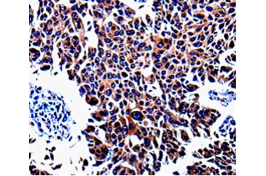 Immunohistochemistry - KLK3 Antibody from Signalway Antibody (35547) - Antibodies.com