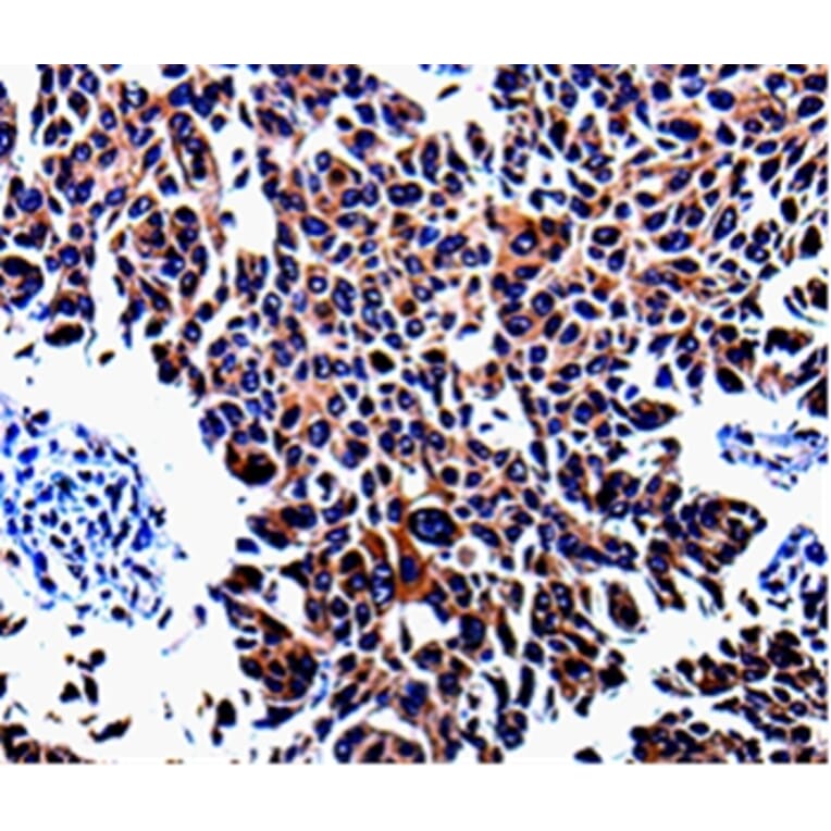 Immunohistochemistry - KLK3 Antibody from Signalway Antibody (35547) - Antibodies.com
