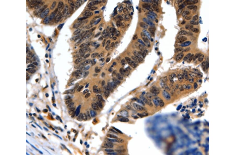 Immunohistochemistry - NEFL Antibody from Signalway Antibody (35557) - Antibodies.com