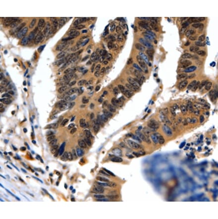 Immunohistochemistry - NEFL Antibody from Signalway Antibody (35557) - Antibodies.com