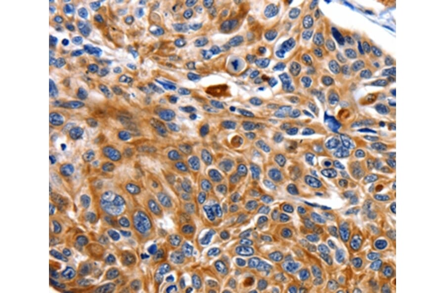 Immunohistochemistry - NEFL Antibody from Signalway Antibody (35557) - Antibodies.com