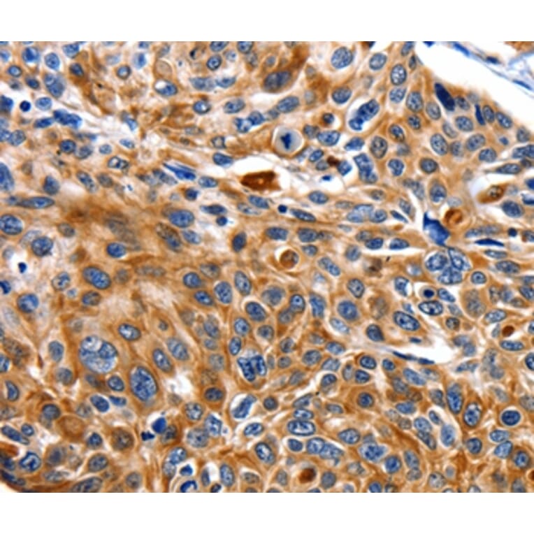 Immunohistochemistry - NEFL Antibody from Signalway Antibody (35557) - Antibodies.com