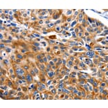 Immunohistochemistry - NEFL Antibody from Signalway Antibody (35557) - Antibodies.com