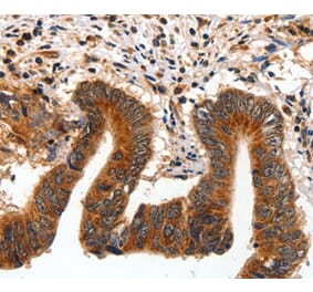 Immunohistochemistry - AKT1 Antibody from Signalway Antibody (35562) - Antibodies.com