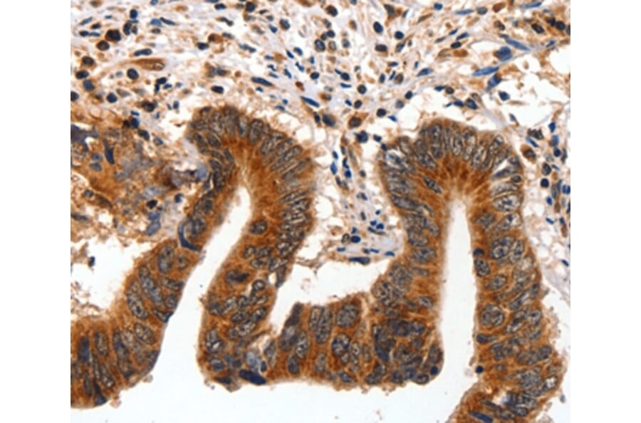 Immunohistochemistry - AKT1 Antibody from Signalway Antibody (35562) - Antibodies.com