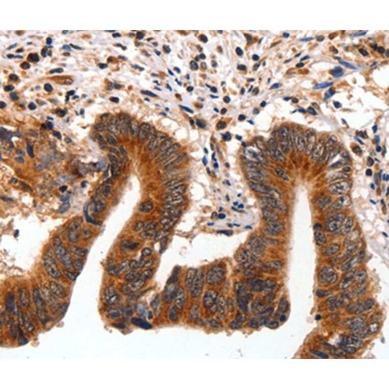 Immunohistochemistry - AKT1 Antibody from Signalway Antibody (35562) - Antibodies.com