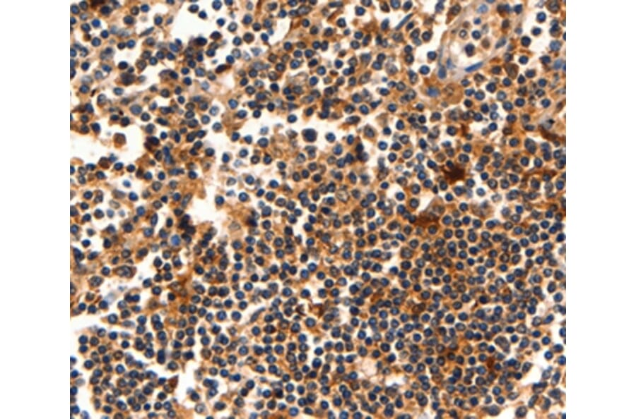 Immunohistochemistry - AKT1 Antibody from Signalway Antibody (35562) - Antibodies.com