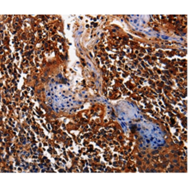 Immunohistochemistry - ALPL Antibody from Signalway Antibody (35565) - Antibodies.com