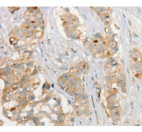 Immunohistochemistry - MMP9 Antibody from Signalway Antibody (35575) - Antibodies.com