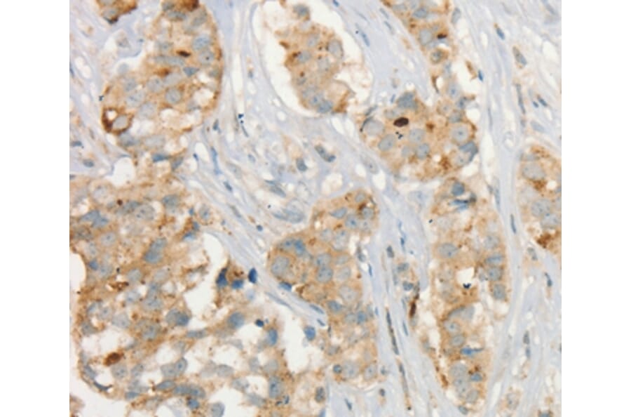 Immunohistochemistry - MMP9 Antibody from Signalway Antibody (35575) - Antibodies.com