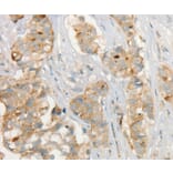 Immunohistochemistry - MMP9 Antibody from Signalway Antibody (35575) - Antibodies.com