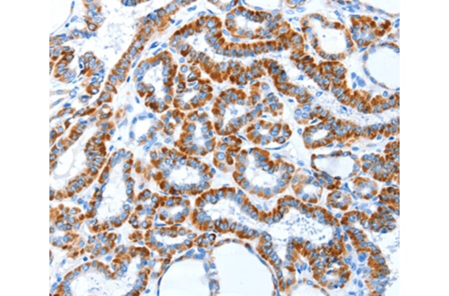 Immunohistochemistry - TLR2 Antibody from Signalway Antibody (35576) - Antibodies.com