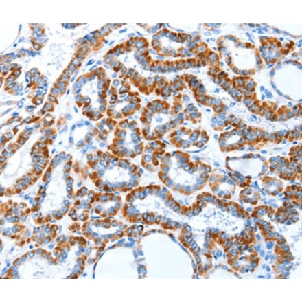 Immunohistochemistry - TLR2 Antibody from Signalway Antibody (35576) - Antibodies.com