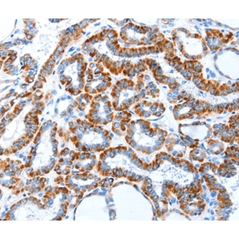 Immunohistochemistry - TLR2 Antibody from Signalway Antibody (35576) - Antibodies.com