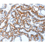 Immunohistochemistry - TLR2 Antibody from Signalway Antibody (35576) - Antibodies.com
