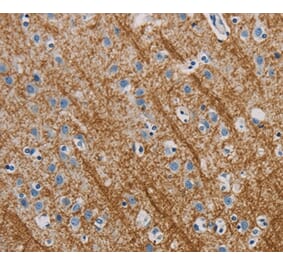 Immunohistochemistry - ABL1 Antibody from Signalway Antibody (35613) - Antibodies.com