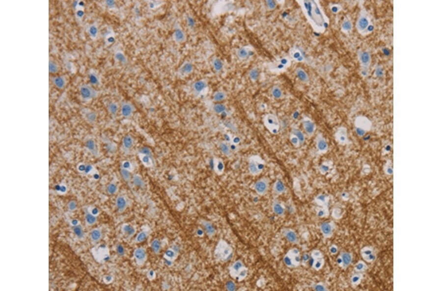 Immunohistochemistry - ABL1 Antibody from Signalway Antibody (35613) - Antibodies.com