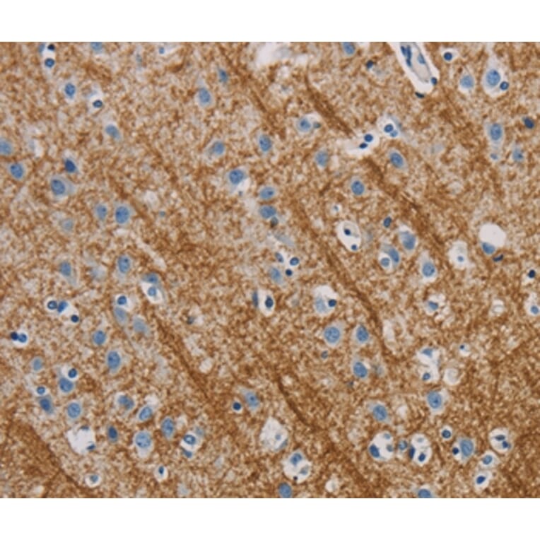 Immunohistochemistry - ABL1 Antibody from Signalway Antibody (35613) - Antibodies.com