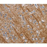 Immunohistochemistry - ABL1 Antibody from Signalway Antibody (35613) - Antibodies.com
