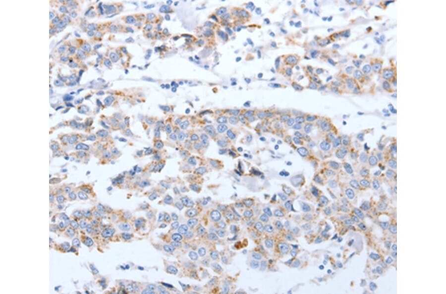 Immunohistochemistry - ARF4 Antibody from Signalway Antibody (35637) - Antibodies.com