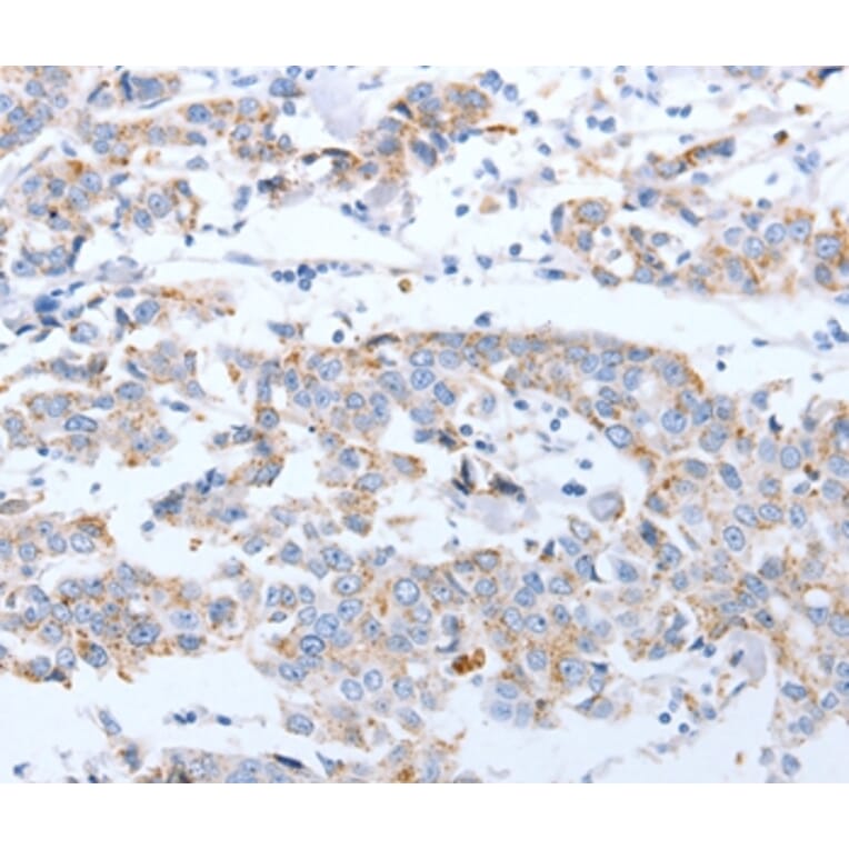 Immunohistochemistry - ARF4 Antibody from Signalway Antibody (35637) - Antibodies.com