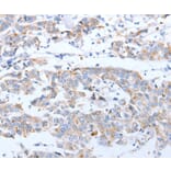 Immunohistochemistry - ARF4 Antibody from Signalway Antibody (35637) - Antibodies.com