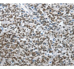 Immunohistochemistry - ARL2 Antibody from Signalway Antibody (35638) - Antibodies.com