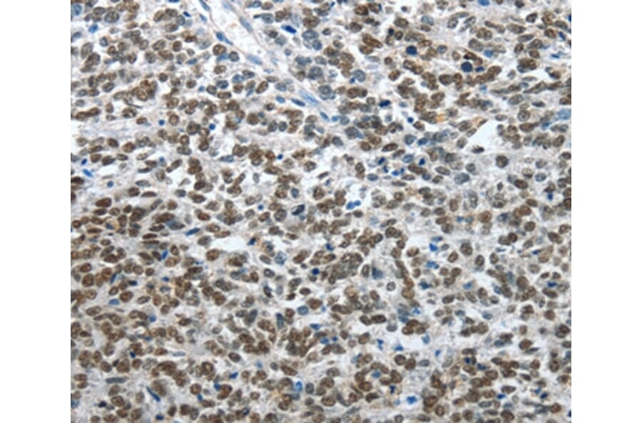 Immunohistochemistry - ARL2 Antibody from Signalway Antibody (35638) - Antibodies.com