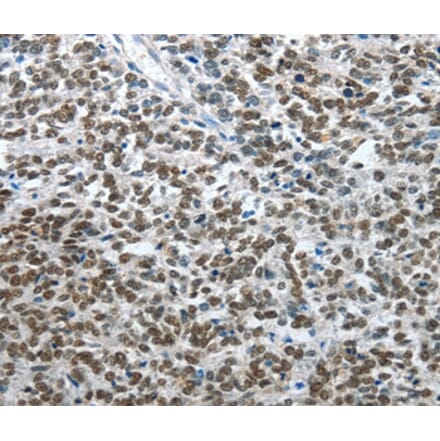 Immunohistochemistry - ARL2 Antibody from Signalway Antibody (35638) - Antibodies.com