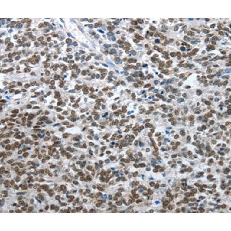 Immunohistochemistry - ARL2 Antibody from Signalway Antibody (35638) - Antibodies.com