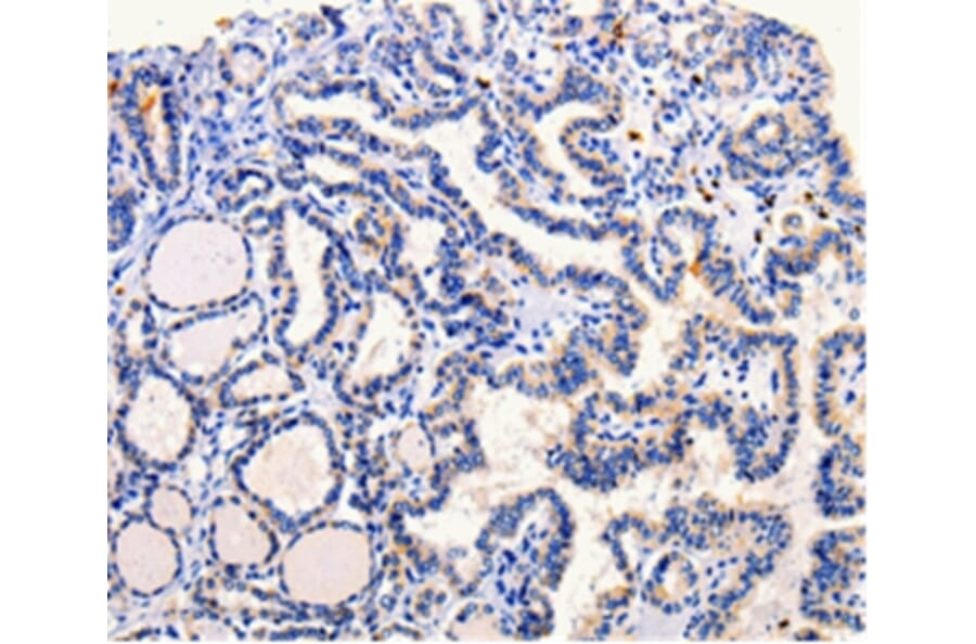 Immunohistochemistry - ARL6 Antibody from Signalway Antibody (35639) - Antibodies.com
