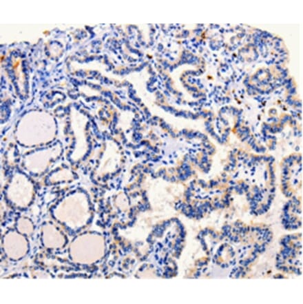 Immunohistochemistry - ARL6 Antibody from Signalway Antibody (35639) - Antibodies.com