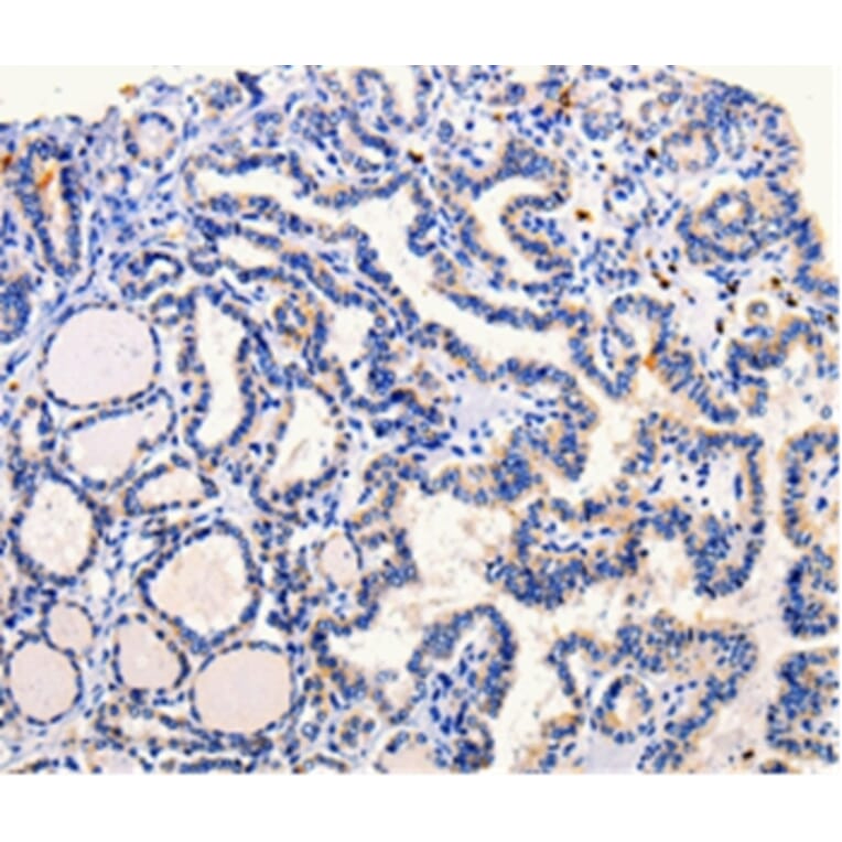 Immunohistochemistry - ARL6 Antibody from Signalway Antibody (35639) - Antibodies.com