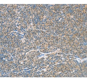 Immunohistochemistry - ATF2 Antibody from Signalway Antibody (35647) - Antibodies.com