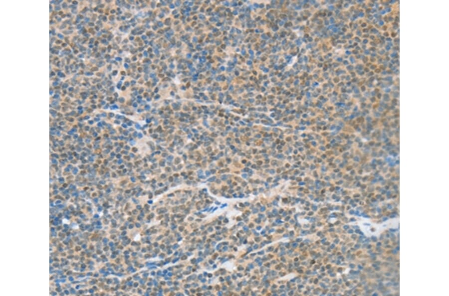 Immunohistochemistry - ATF2 Antibody from Signalway Antibody (35647) - Antibodies.com