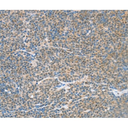 Immunohistochemistry - ATF2 Antibody from Signalway Antibody (35647) - Antibodies.com
