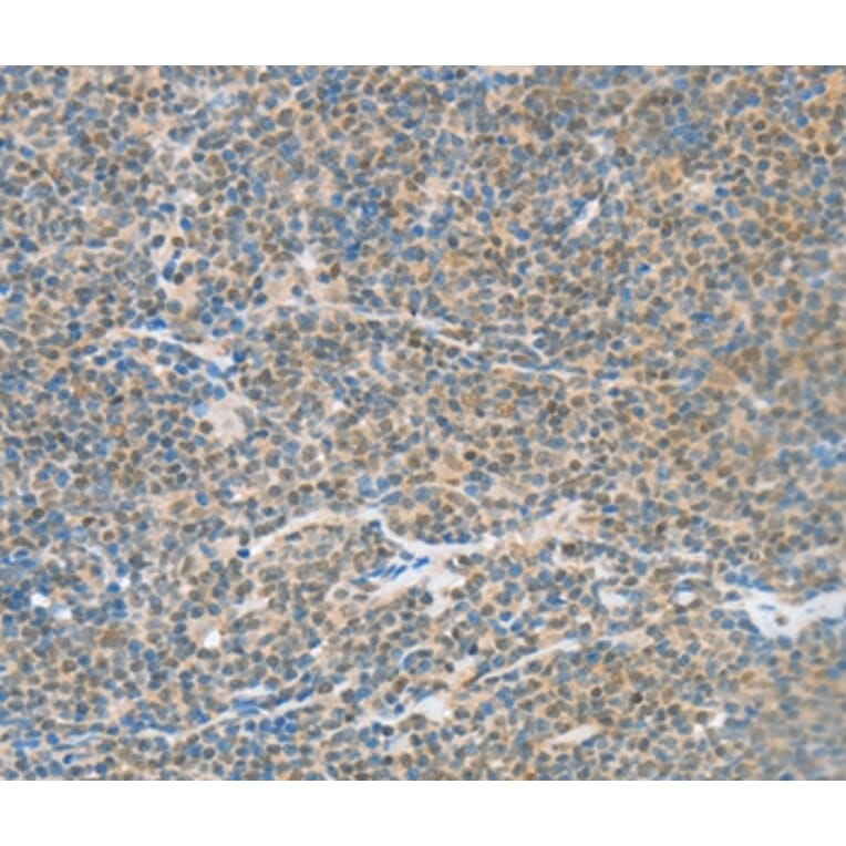 Immunohistochemistry - ATF2 Antibody from Signalway Antibody (35647) - Antibodies.com