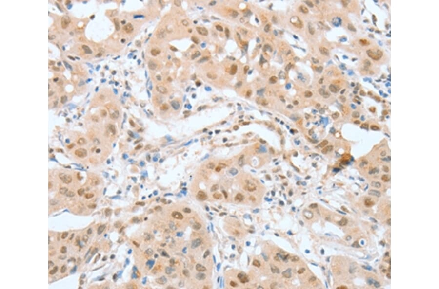 Immunohistochemistry - ATF2 Antibody from Signalway Antibody (35647) - Antibodies.com