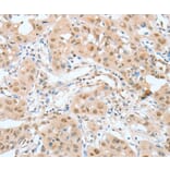 Immunohistochemistry - ATF2 Antibody from Signalway Antibody (35647) - Antibodies.com