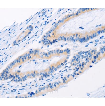 Immunohistochemistry - BMP3 Antibody from Signalway Antibody (35653) - Antibodies.com