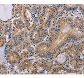 Immunohistochemistry - BTG1 Antibody from Signalway Antibody (35654) - Antibodies.com