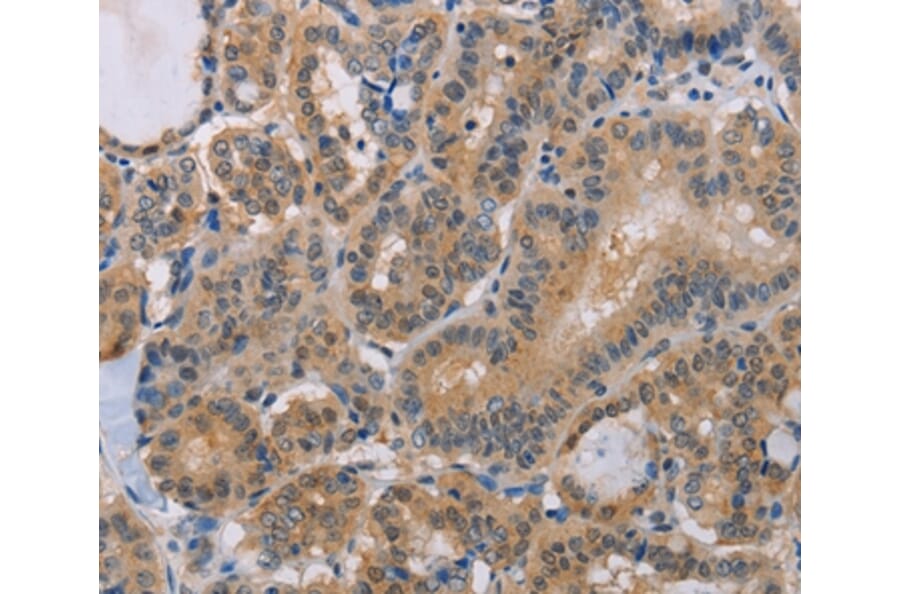 Immunohistochemistry - BTG1 Antibody from Signalway Antibody (35654) - Antibodies.com