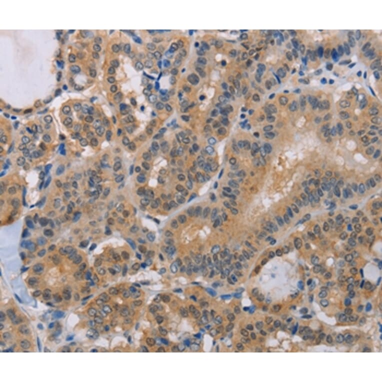 Immunohistochemistry - BTG1 Antibody from Signalway Antibody (35654) - Antibodies.com