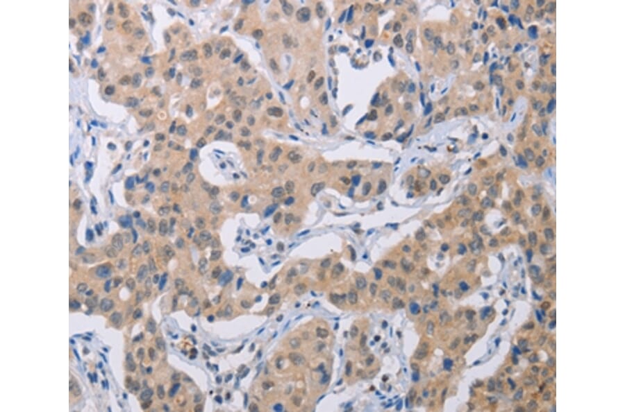 Immunohistochemistry - BTG1 Antibody from Signalway Antibody (35654) - Antibodies.com