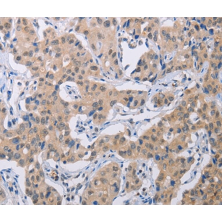 Immunohistochemistry - BTG1 Antibody from Signalway Antibody (35654) - Antibodies.com