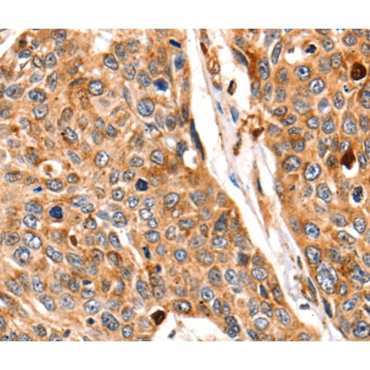 Immunohistochemistry - CTSB Antibody from Signalway Antibody (35665) - Antibodies.com