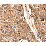 Immunohistochemistry - CTSB Antibody from Signalway Antibody (35665) - Antibodies.com