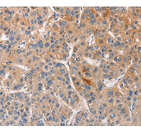 Immunohistochemistry - CCL4 Antibody from Signalway Antibody (35672) - Antibodies.com