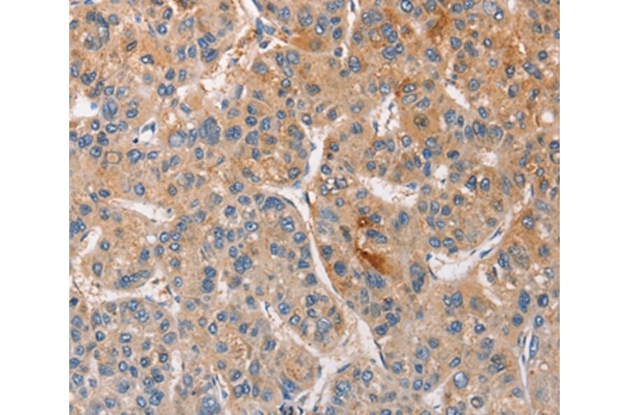 Immunohistochemistry - CCL4 Antibody from Signalway Antibody (35672) - Antibodies.com